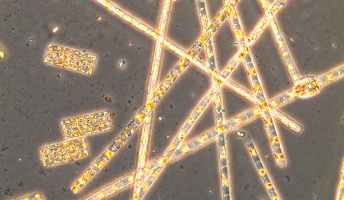 Espécies de algas diatomáceas Guinardia flaccida e Guinardia delicatula - Foto: Isabel G. Teixeira