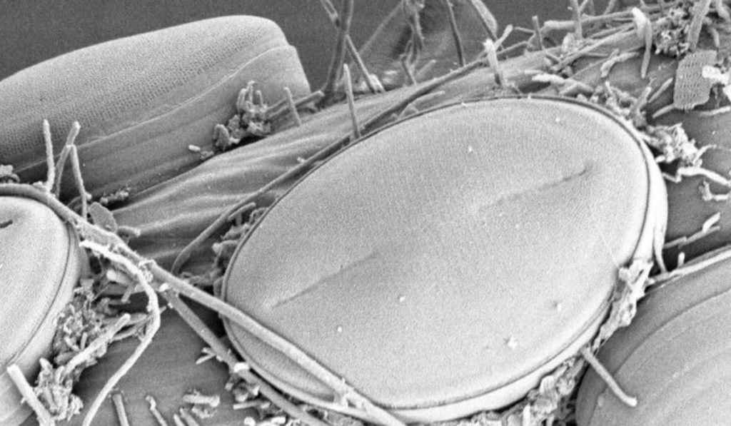 Microrganismos descobertos - visão no microscópio