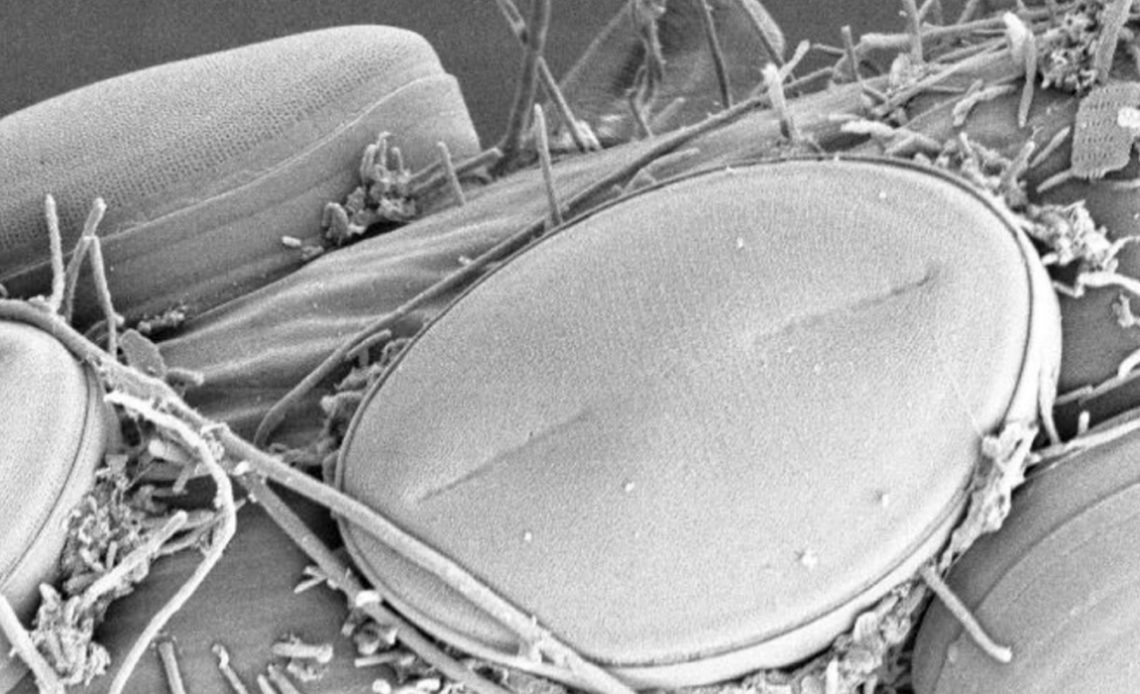 Microrganismos descobertos - visão no microscópio