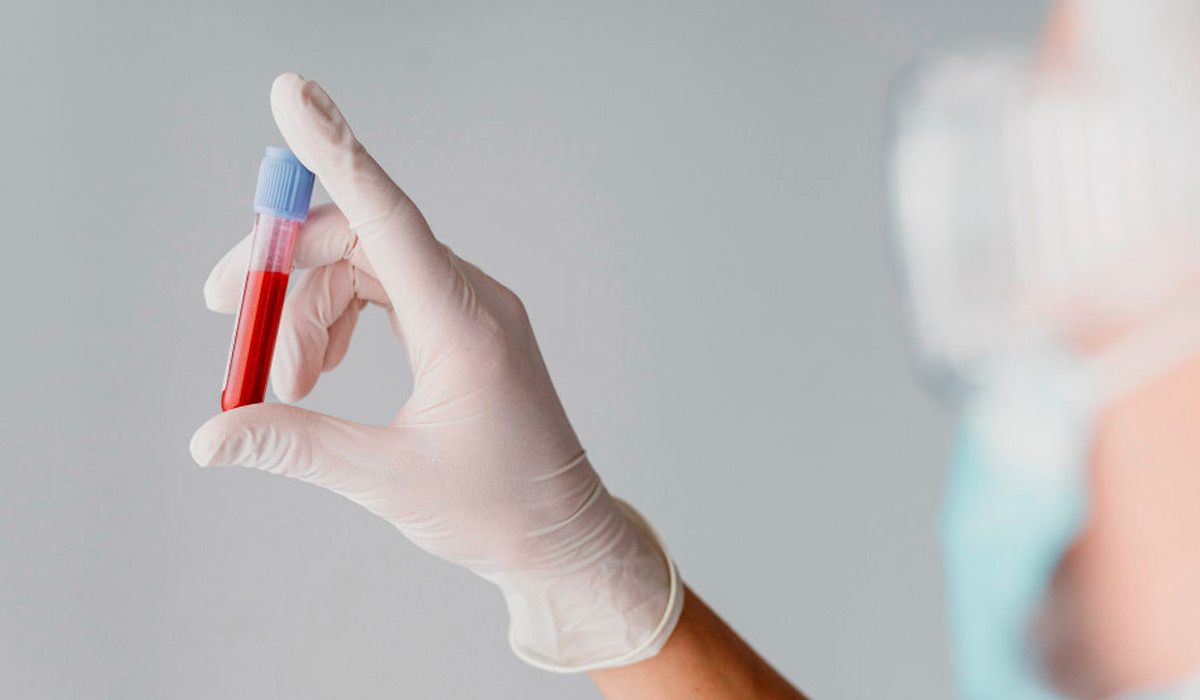 Sangue coletado para exame laboratorial