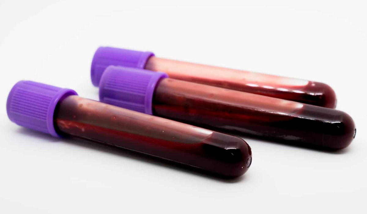 Tubos de coleta com sangue para exame