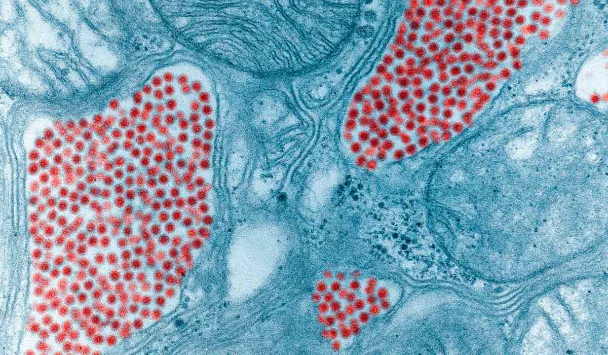 Micrografia eletrônica da glândula salivar de um mosquito que contém vírus da encefalite equina oriental. O mosquito é infetado com o vírus quando se alimenta do sangue de um animal virémico. O vírus amadurece e dissemina-se nos órgãos e eventualmente acumula-se nas glândulas salivares do mosquito - Foto: "Colourised TEM micrograph" por Fred Murphy and Sylvia Whitfield – CDC Micrografia eletrônica da glândula salivar de um mosquito que contém vírus da encefalite equina oriental. O mosquito é infetado com o vírus quando se alimenta do sangue de um animal virémico. O vírus amadurece e dissemina-se nos órgãos e eventualmente acumula-se nas glândulas salivares do mosquito - Foto: "Colourised TEM micrograph" por Fred Murphy and Sylvia Whitfield – CDC