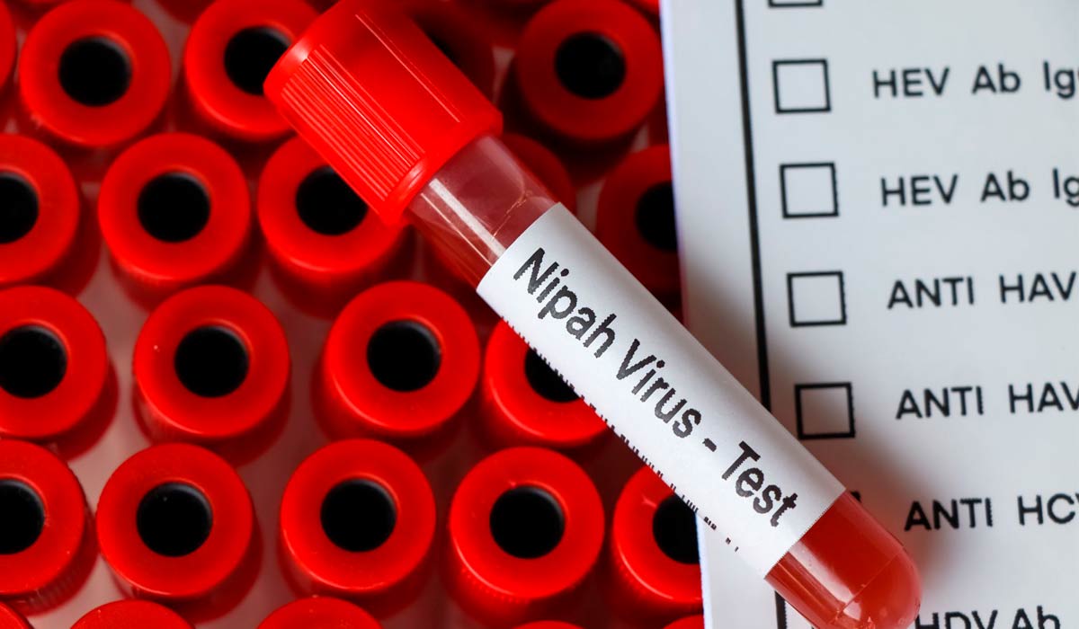 Alerta global para o vírus Nipah