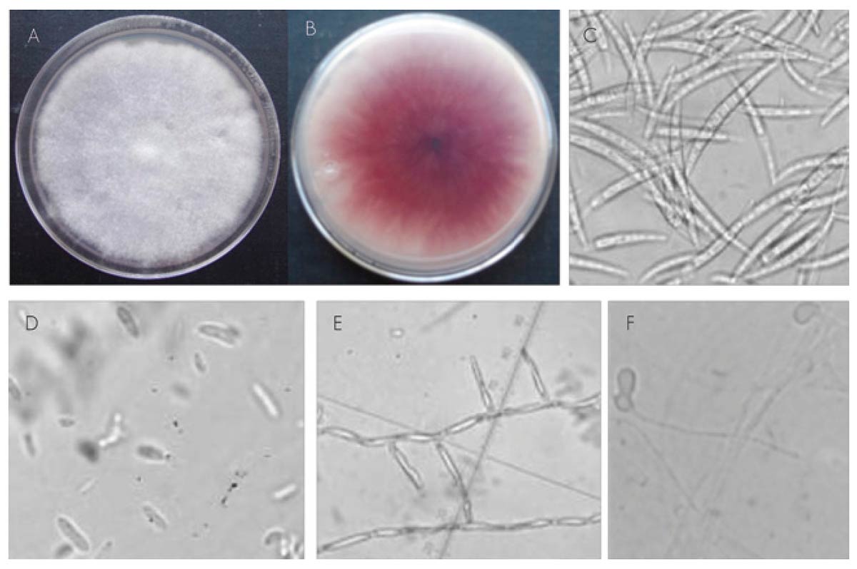 O Fusarium oxysporum - A) Colônia com 8 dias de idade; B) Lado reverso da colônia com coloração vermelho-púrpura; C) Macroconídios; D) Microconídios; E) Fiálides; F) Clamidósporos O Fusarium oxysporum - A) Colônia com 8 dias de idade; B) Lado reverso da colônia com coloração vermelho-púrpura; C) Macroconídios; D) Microconídios; E) Fiálides; F) Clamidósporos