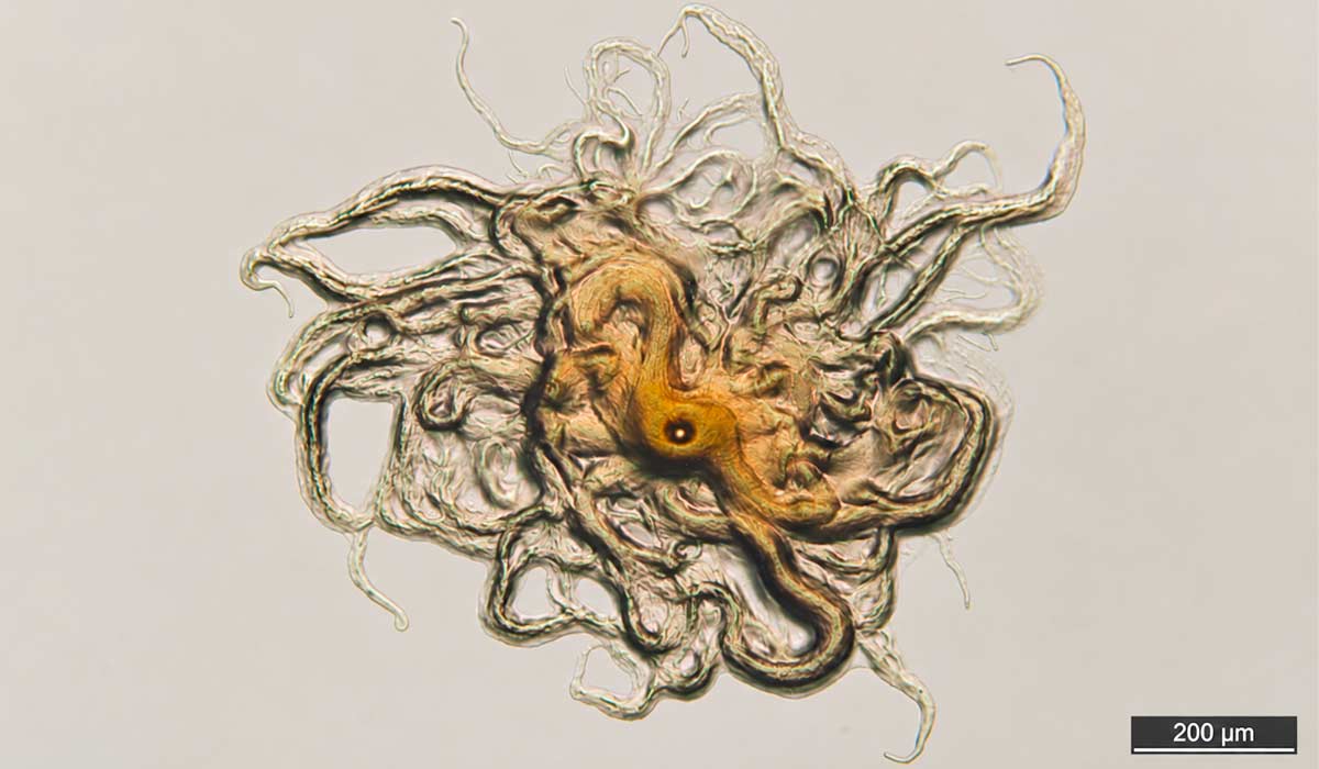 Pesquisa identifica novas espécies de bactérias associadas à columnariose em peixes cultivados. Colônia de Flavobacterium oreochromis aumentada em 40 vezes por fotomicroscopia - Foto: Daniel Ferreira/Caunesp Pesquisa identifica novas espécies de bactérias associadas à columnariose em peixes cultivados. Colônia de Flavobacterium oreochromis aumentada em 40 vezes por fotomicroscopia - Foto: Daniel Ferreira/Caunesp